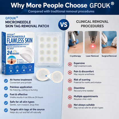 🔥𝐎𝐟𝐟𝐢𝐜𝐢𝐚𝐥 𝐒𝐭𝐨𝐫𝐞 | GFOUK® 🌿 𝐁𝐨𝐭𝐚𝐧𝐢𝐜𝐚𝐥 𝐌𝐢𝐜𝐫𝐨𝐧𝐞𝐞𝐝𝐥𝐞 𝐇𝐲𝐝𝐫𝐨𝐜𝐨𝐥𝐥𝐨𝐢𝐝 𝐏𝐚𝐭𝐜𝐡 (𝐅𝐨𝐫 𝐒𝐤𝐢𝐧 𝐓𝐚𝐠𝐬, 𝐒𝐦𝐚𝐥𝐥 𝐒𝐤𝐢𝐧 𝐆𝐫𝐨𝐰𝐭𝐡𝐬, 𝐖𝐚𝐫𝐭𝐬, 𝐌𝐨𝐥𝐞𝐬, 𝐀𝐠𝐞 𝐒𝐩𝐨𝐭𝐬 & 𝐏𝐢𝐠𝐦𝐞𝐧𝐭𝐚𝐭𝐢𝐨𝐧 𝐂𝐨𝐧𝐜𝐞𝐫𝐧𝐬)