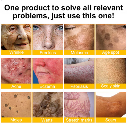 💫😍Rolimey® Bee venom Pro Comprehensive Cream —Tightening for Skin Types 🔥🔥