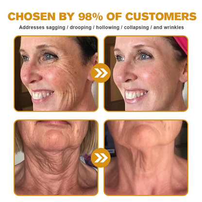 💫😍Rolimey® Bee venom Pro Comprehensive Cream —Tightening for Skin Types 🔥🔥