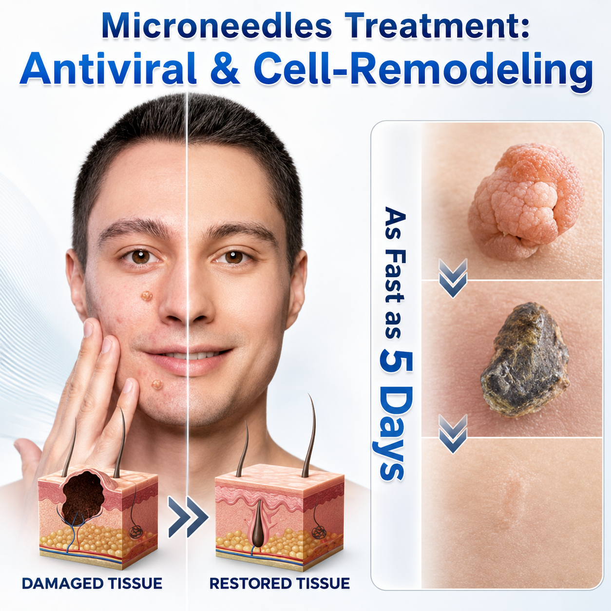 👩‍⚕️🏆 𝐎𝐟𝐟𝐢𝐜𝐢𝐚𝐥 𝐒𝐭𝐨𝐫𝐞 | GFOUK® 🌿Botanical Microneedle Hydrocolloid Patch (𝐅𝐨𝐫 𝐒𝐤𝐢𝐧 𝐓𝐚𝐠𝐬, 𝐒𝐦𝐚𝐥𝐥 𝐒𝐤𝐢𝐧 𝐆𝐫𝐨𝐰𝐭𝐡𝐬, 𝐖𝐚𝐫𝐭𝐬, 𝐌𝐨𝐥𝐞𝐬, 𝐀𝐠𝐞 𝐒𝐩𝐨𝐭𝐬 & 𝐏𝐢𝐠𝐦𝐞𝐧𝐭𝐚𝐭𝐢𝐨𝐧 𝐂𝐨𝐧𝐜𝐞𝐫𝐧𝐬)