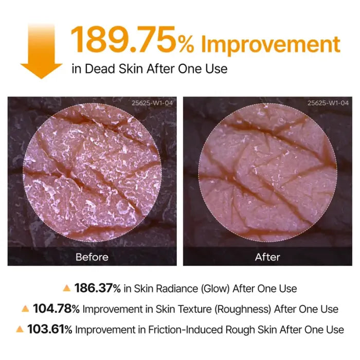 Over 100,000 Units Sold 💕 – Hudros® Body Exfoliating Spray to Smooth Rough Skin and Reduce the Look of Dark Spots