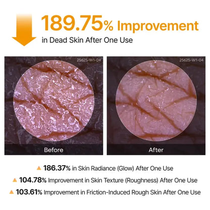 Over 100,000 Units Sold 💕 – Hudros® Body Exfoliating Spray to Smooth Rough Skin and Reduce the Look of Dark Spots