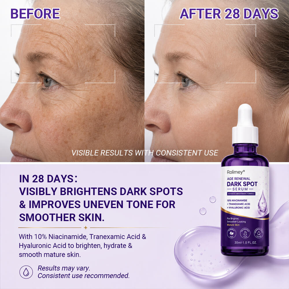 Rolimey® Age Renewal Dark Spot Serum — Infused with 10% Niacinamide, Tranexamic Acid & Hyaluronic Acid for Brighter, Smoother-Looking Mature Skin