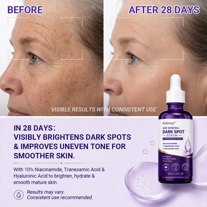 Rolimey® Age Renewal Dark Spot Serum — Infused with 10% Niacinamide, Tranexamic Acid & Hyaluronic Acid for Brighter, Smoother-Looking Mature Skin