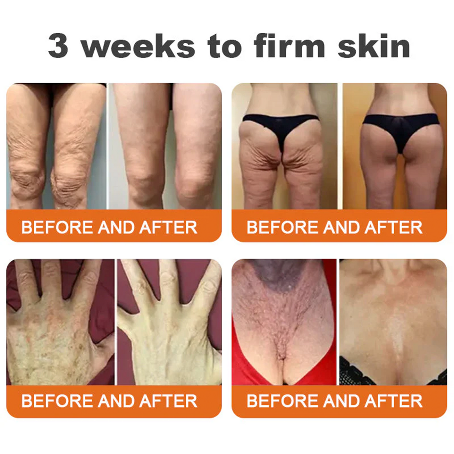 💫😍Rolimey® Bee venom Pro Comprehensive Cream —Tightening for Skin Types 🔥🔥