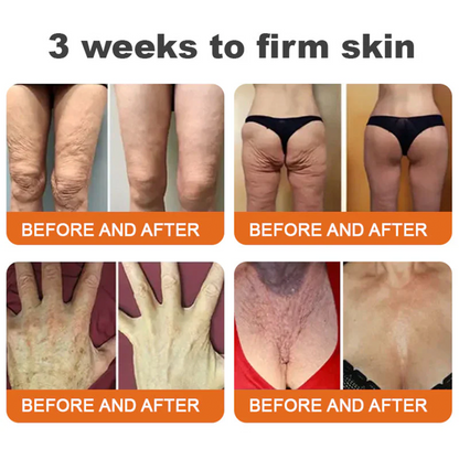 💫😍Rolimey® Bee venom Pro Comprehensive Cream —Tightening for Skin Types 🔥🔥