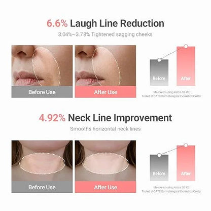 Toclvo® PDRN Collagen Volufiline Multi-Balm | Advanced Anti-Aging Volume Booster & Total Wrinkle Eraser