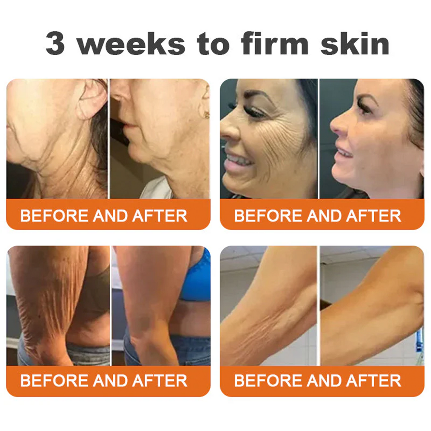 💫😍Rolimey® Bee venom Pro Comprehensive Cream —Tightening for Skin Types 🔥🔥