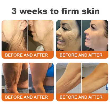 💫😍Rolimey® Bee venom Pro Comprehensive Cream —Tightening for Skin Types 🔥🔥